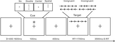 Anodal transcranial direct current stimulation (tDCS) over the left dorsolateral prefrontal cortex improves attentional control in chronically stressed adults